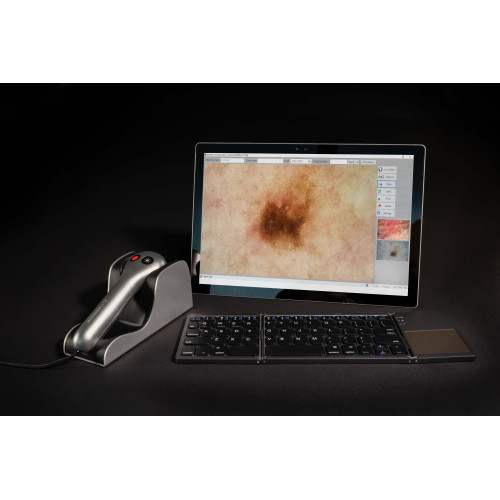 MoleMax Lite Pro